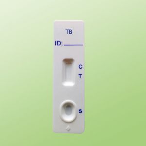 Tuberculosis(TB)